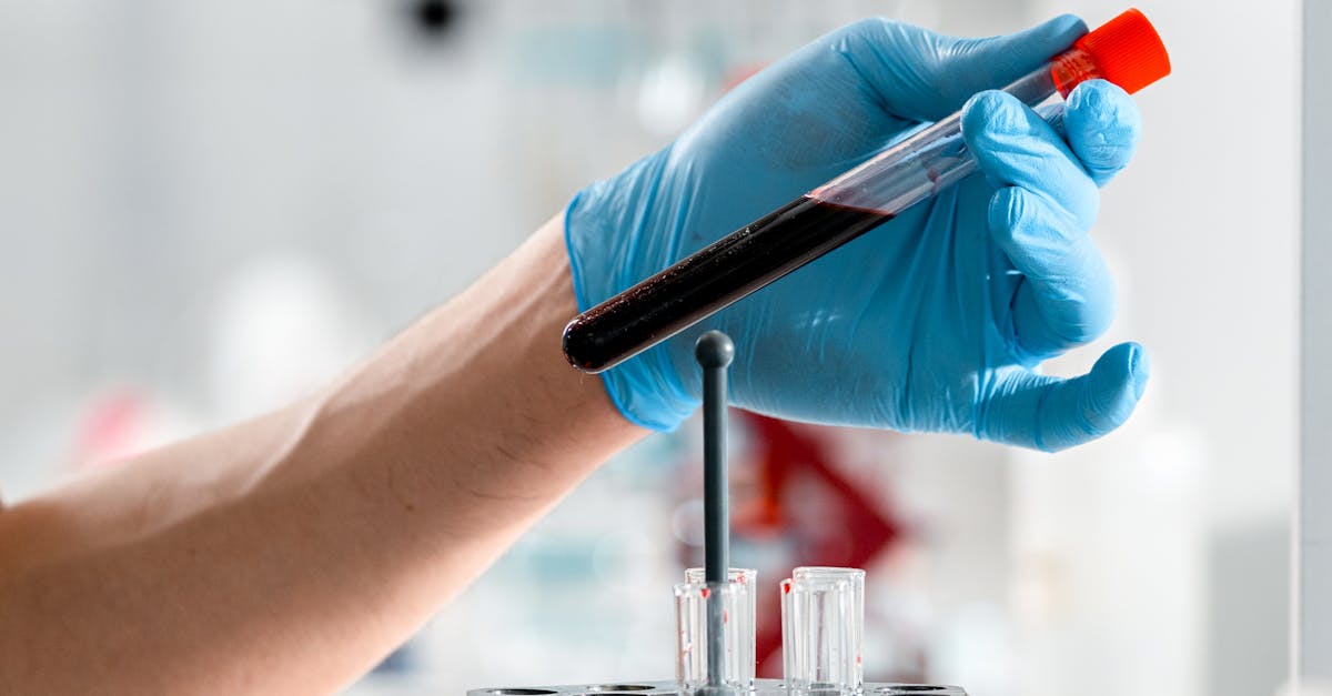 Technicien de laboratoire en gants tenant un tube de sang pour analyse médicale dans un laboratoire clinique moderne